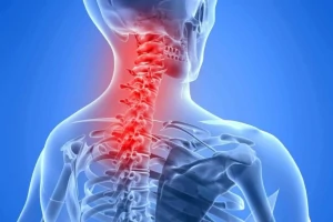 Image of person with neck pain