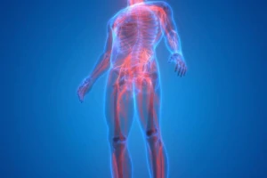 Picture of nerve pain throughout a person